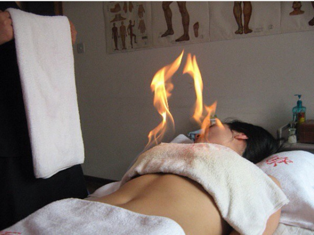 Masaj cu foc