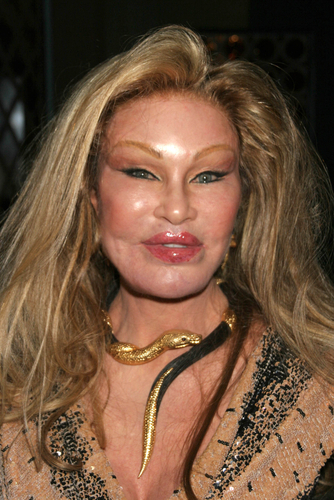 Jocelyn Wildenstein