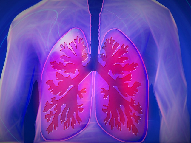 Cancere pulmonare si ale cailor respiratorii