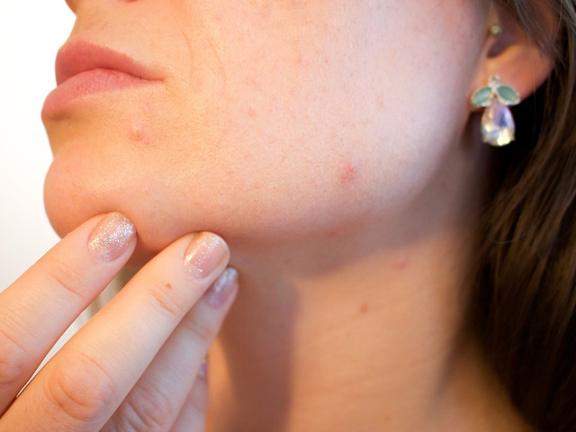 Nu folosesti produsele de ingrijire care se potrivesc tenului tau