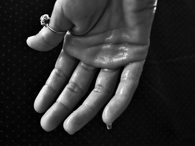 Transpiratie excesiva