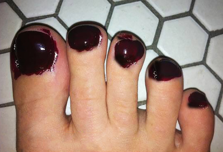 Si pedichiura e o provocare, pentru femeile insarcinate