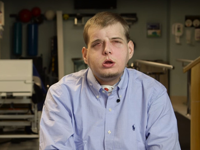 Transplanturile faciale totale sunt din ce in ce mai fezabile