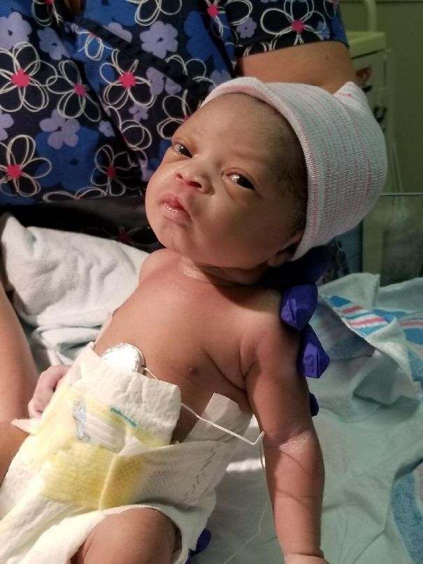 Imagini cu bebelusi care s-au nascut "batrani"