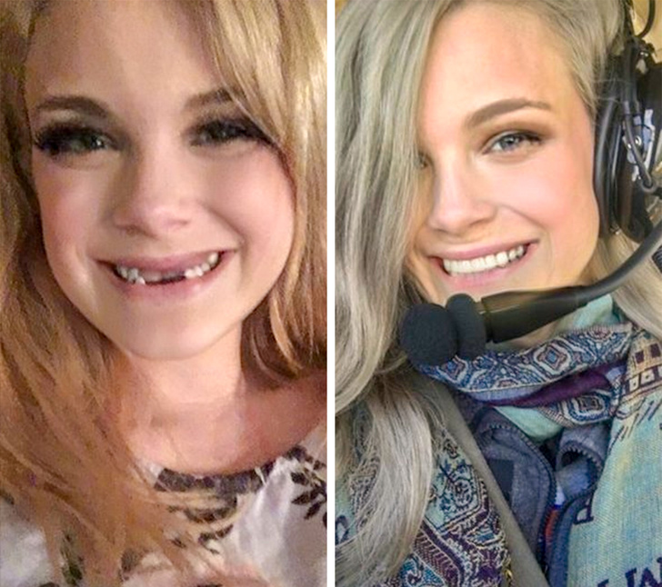 A invins bulimia si si-a facut curaj sa mearga la dentist. Rezultatul de remarcabil