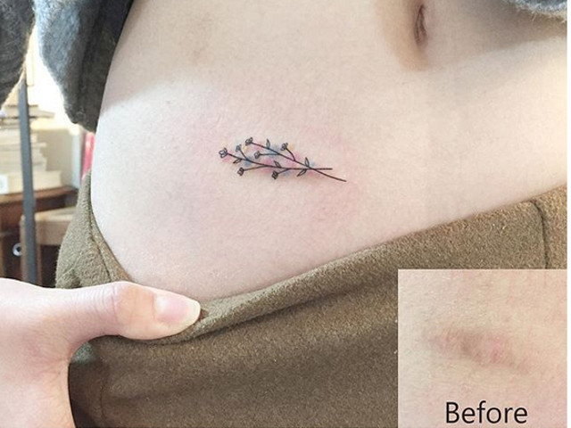 Nu conteaza cat de mica sau mare este imperfectiunea, ea se poate rezolva