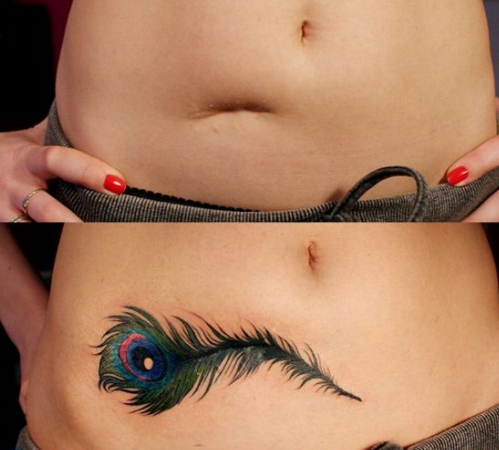 Chiar si cea mai urata cicatrice se poate transforma intr-o opera de arta