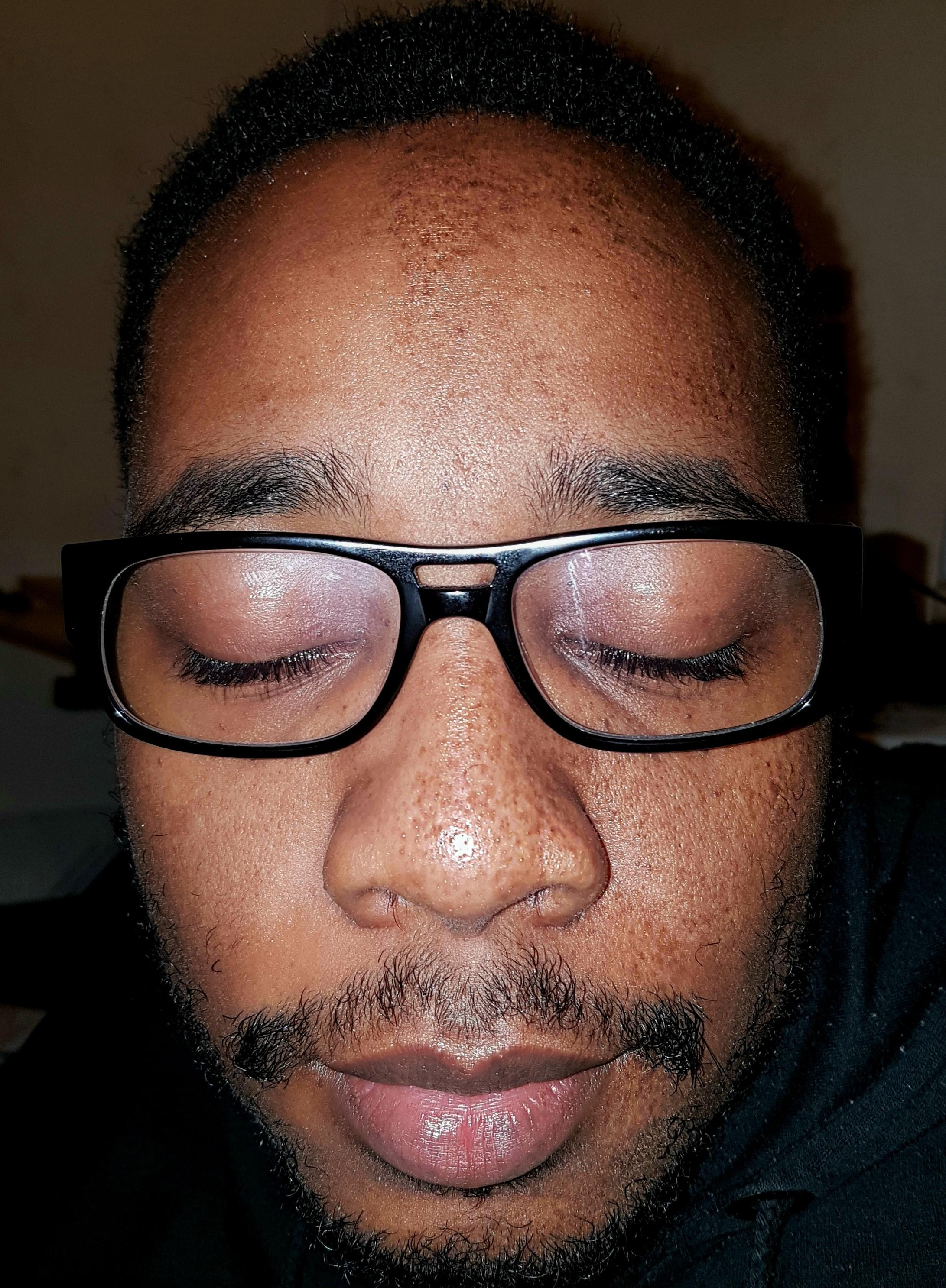 Are pistrui doar pe jumatate pe fata