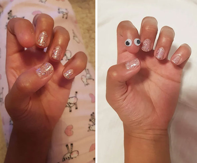 O tanara s-a nascut fara unghia degetului aratator