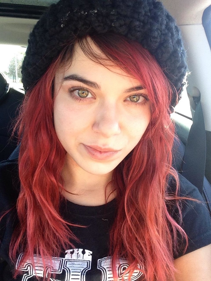 O tanara care a scapat in sfarsit de acnee si-a facut curaj si a publicat pe internet prima ei poza fara machiaj