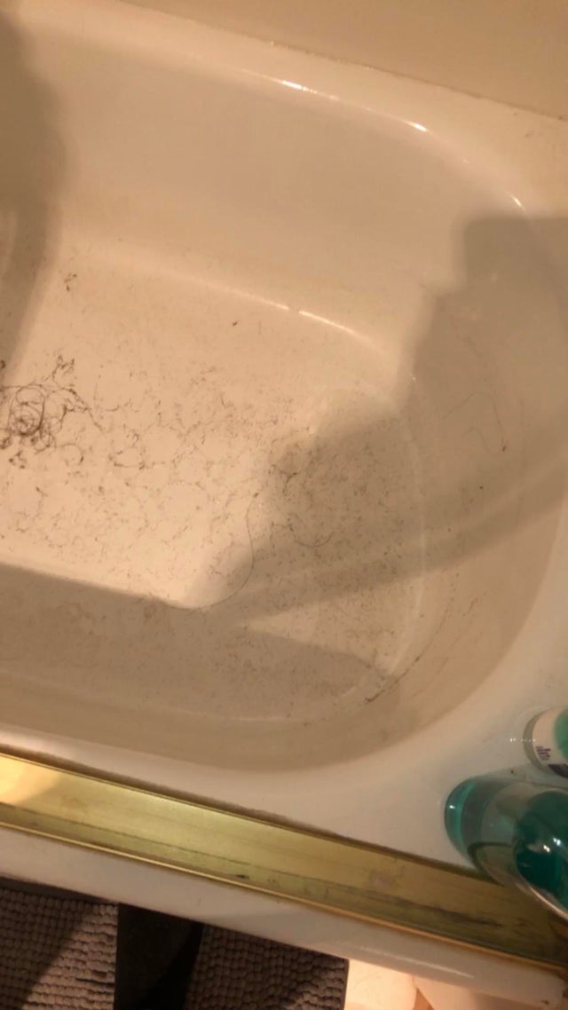 Colega ei de camera se epileaza in cada si o lasa murdara