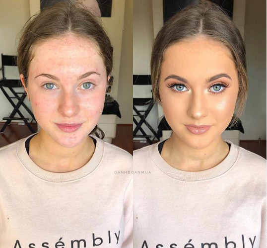 Ai probleme cu tenul pe care vrei sa le ascunzi? Problema rezolvata!