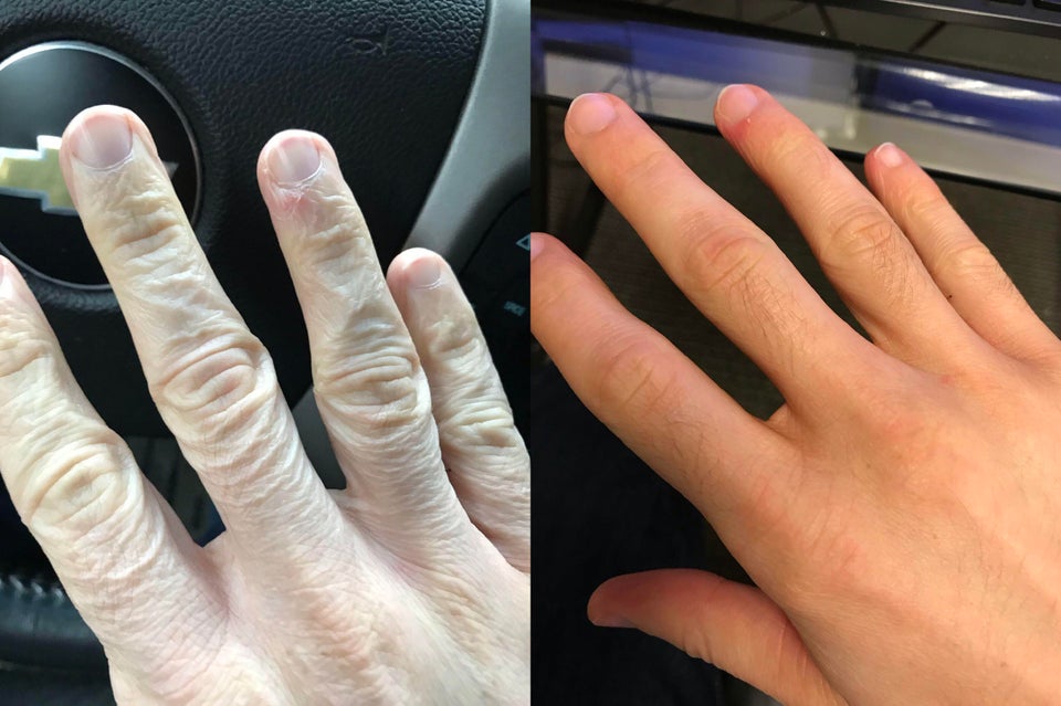 Hidratarea corespunzatoare te poate intineri