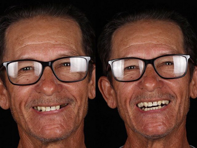 "Zambetul este curcubeul lacrimilor" (Jules Renard)