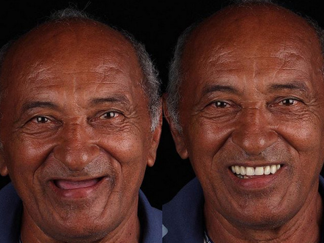 Transformare de-a dreptul uimitoare