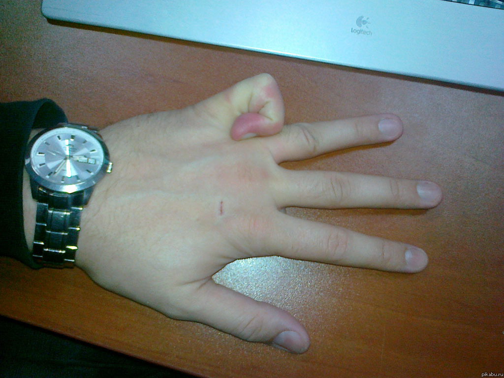 Nu are degetul rupt, ci doar foarte flexibil