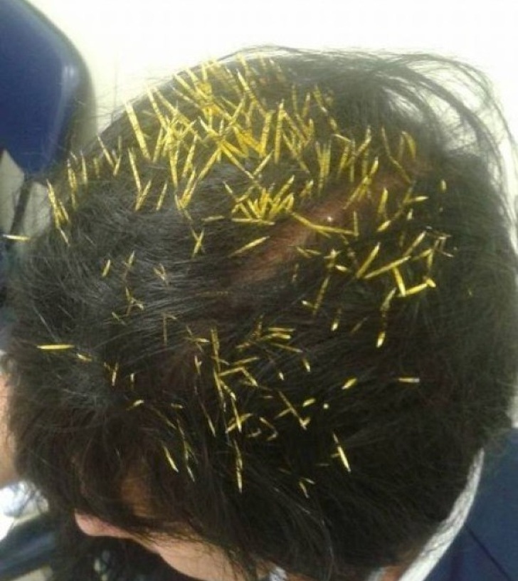 Un porc spinos a cazut din copac direct pe capul ei