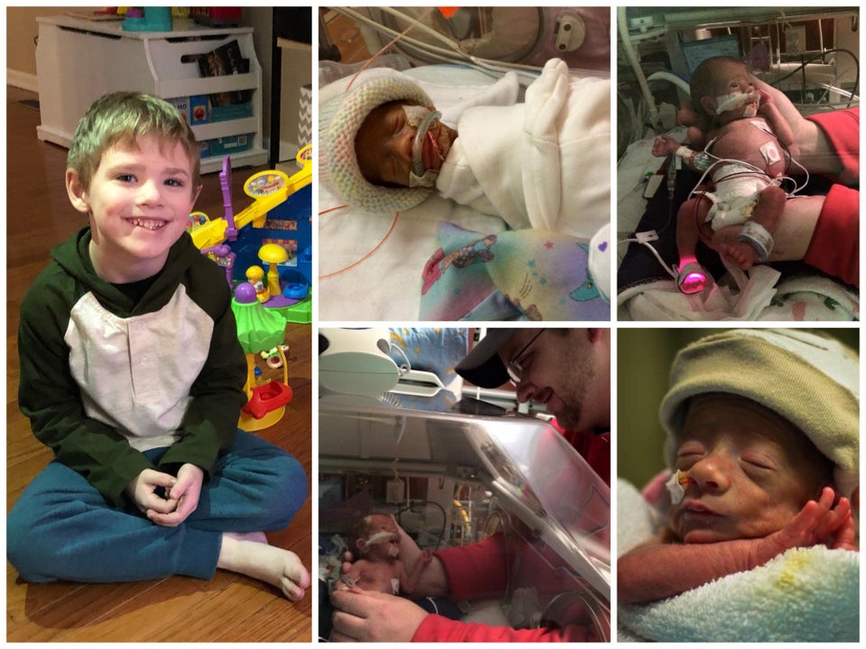 Baietelul s-a nascut prematur, iar doctorii nu ii dadeau sanse de supravietuire. Acum are 5 ani