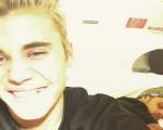 Justin Bieber, selfie cu dintele de aur