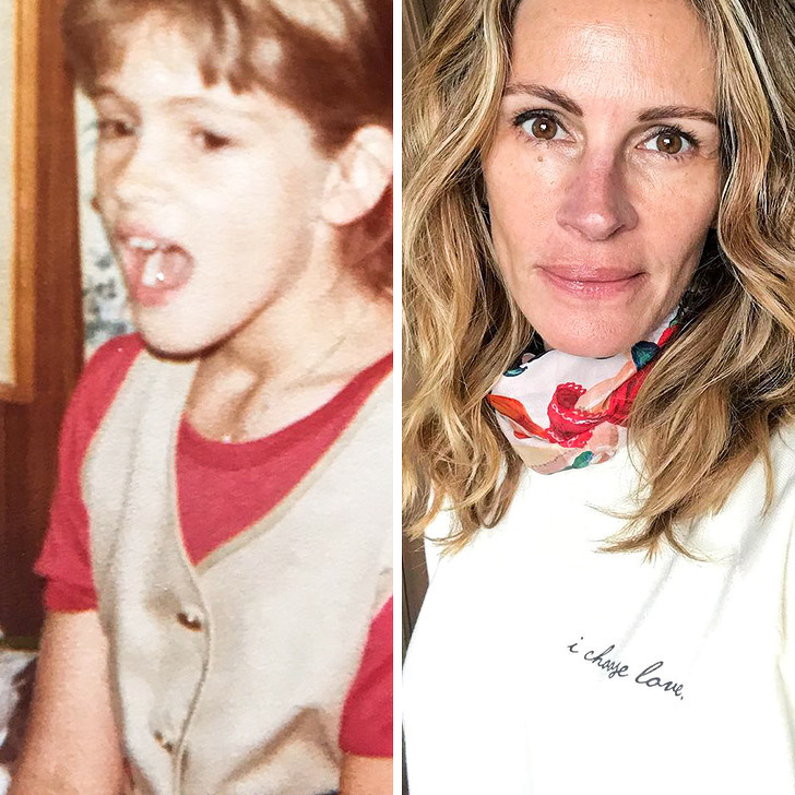 Vedete care s-au schimbat după ce au devenit faimoase: Julia Roberts