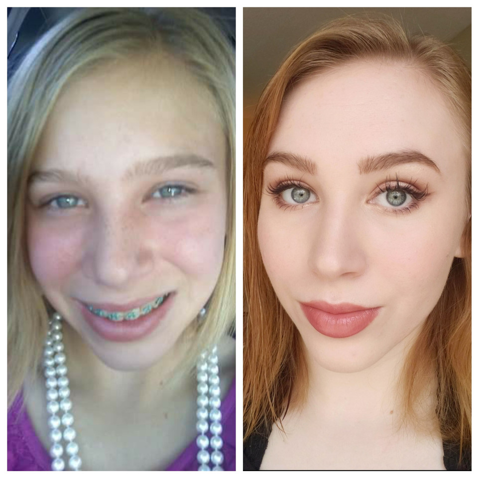 Diferență de 8 ani între cele două fotografii