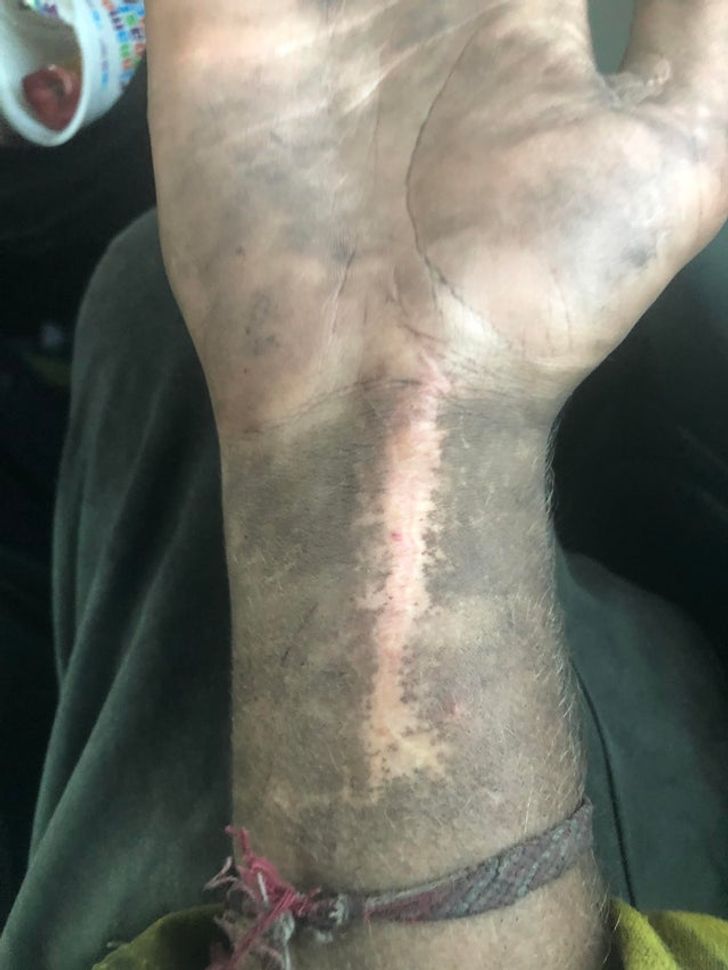 „Murdăria și cenușa nu se lipesc de cicatricea mea”