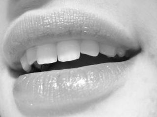 Senzatia de arsura in gura poate fi un semn ca organismul tau nu are aportul de vitamine necesar