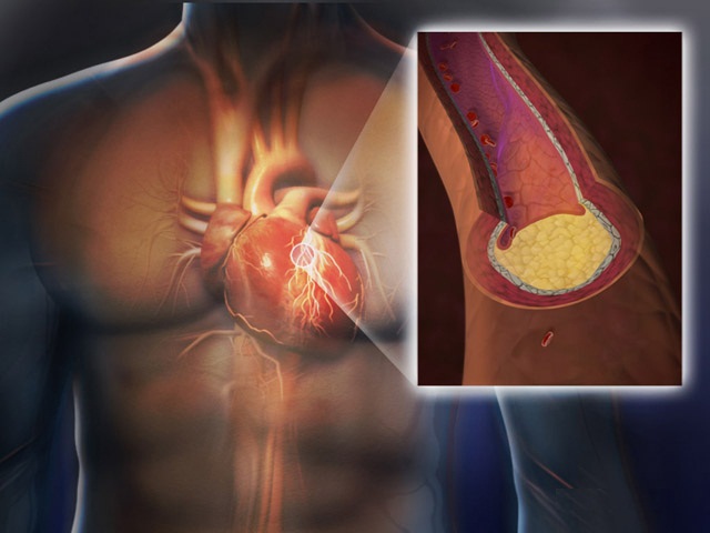 Contribuie la scaderea colesterolului