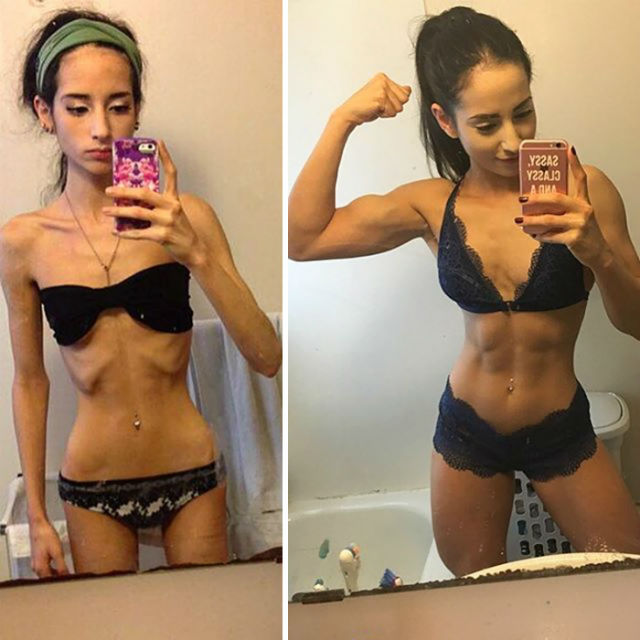 pierderea în greutate înainte și după anorexie