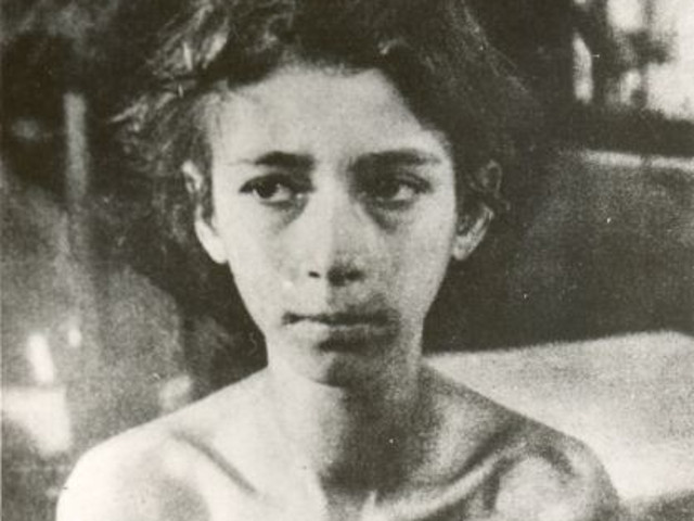 Experimentele lui Josef Mengele implicau gemeni. Daca unul dintre ei murea in timpul operatiunii, era ucis si celalalt pentru a se face autopsii comparative