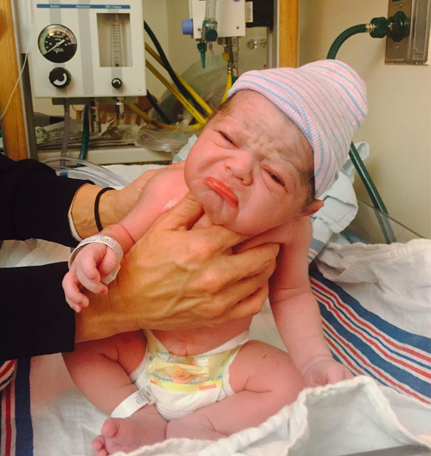 Imagini cu bebelusi care s-au nascut "batrani"