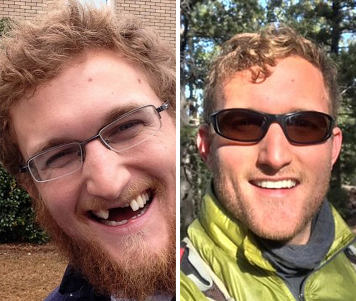 O dantura noua schimba aproape complet chipul unei persoane