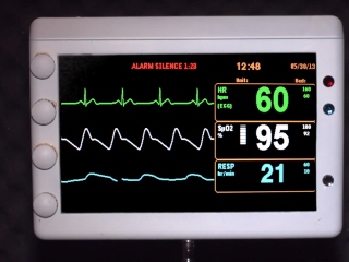 Monitorizarea pacientilor