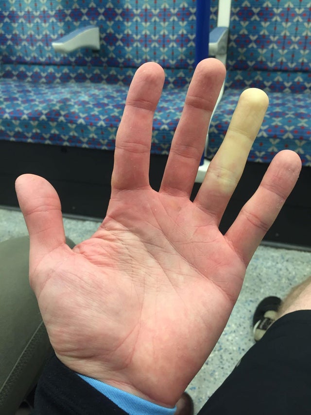 Atunci cand ii este frig, degetul sau inelar devine alb