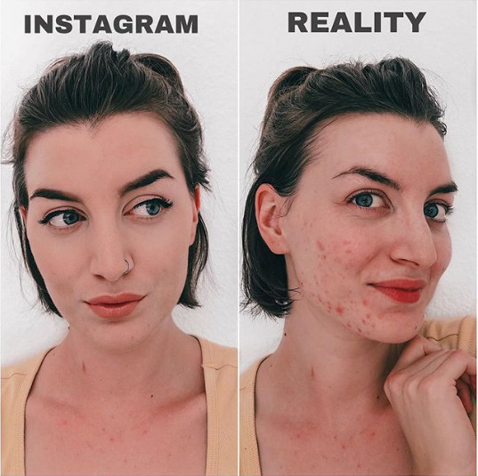 Ce se ascunde in spatele unui ten fara imperfectiuni: