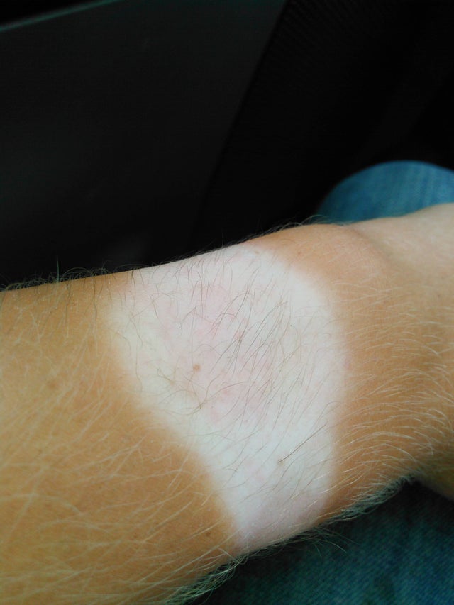 Asta inseamna sa te bronzezi cu ceasul la mana